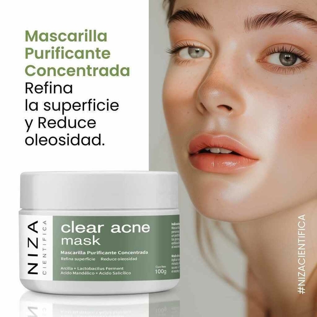 CLEAR ACNE MASK Mascara arcillosa purificante piel acneica y oleosa x 100ml NIZA